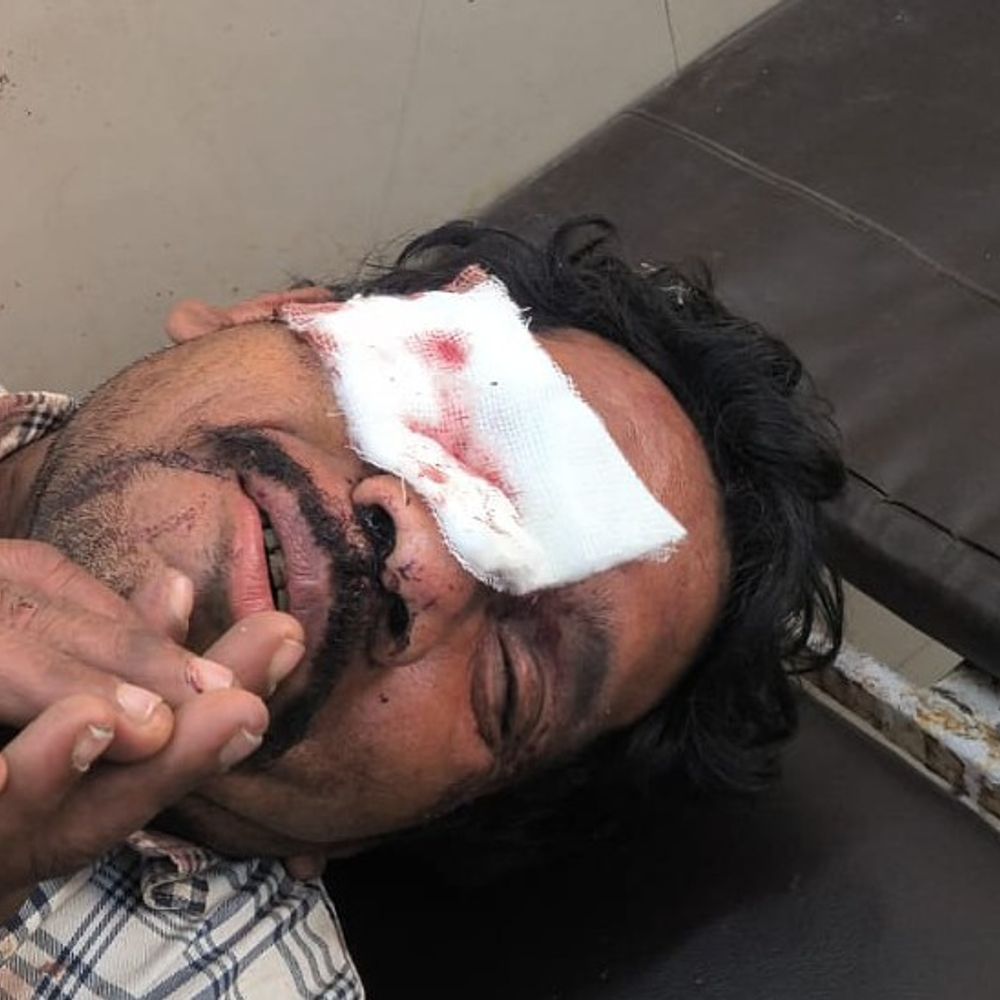 बेंच पर बैठने को लेकर विवाद,युवक की आंख फोड़ी:बहराइच के शंकरपुर चौराहे पर वारदात, कैंची से किया हमला