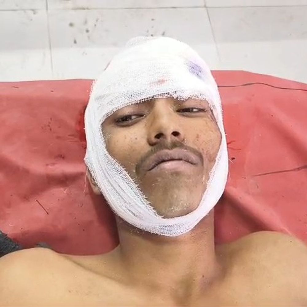 महोबा में छात्र को अगवा कर पीटा, अचेत मिला:पुरानी रंजिश के चलते दबंगों ने बेल्ट व लाठियों से बेरहमी से पीटा