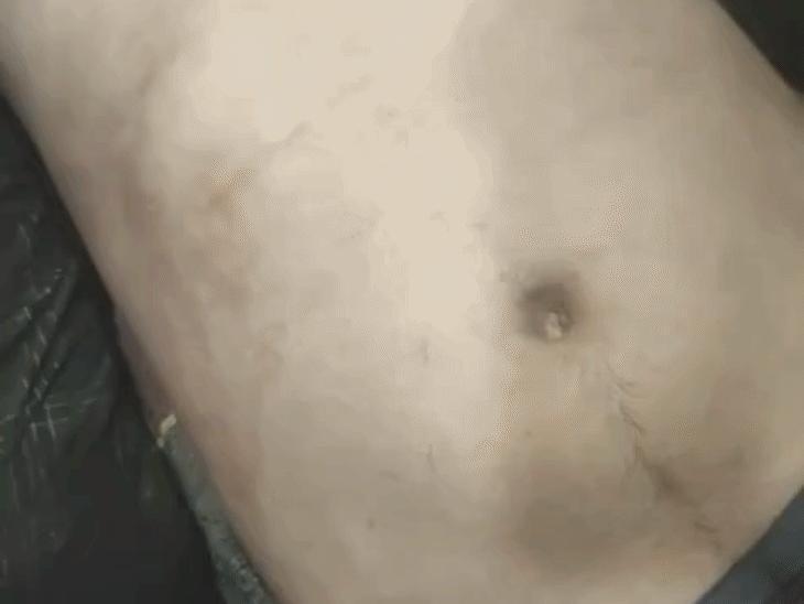 फरार हिस्ट्रीशीटर भय्यू लाला की संदिग्ध परिस्थितियों में मौत:  मंदसौर में रेड के दौरान दीवान में लाश मिलने का दावा; परिजन बोले- पुलिस ने पीट-पीटकर मारा – Mandsaur News