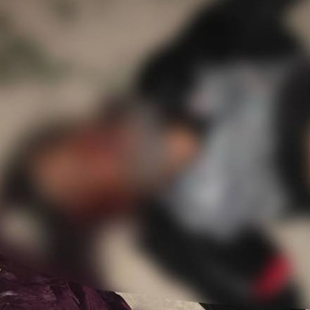 उन्नाव में ट्रैक्टर-ट्रॉली पलटने से युवक की मौत:लकड़ियों के नीचे दबा, बाहर निकालने से पहले तोड़ा दम