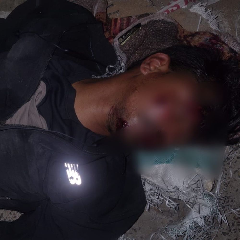 उमरिया में NH-43 पर बाइक गड्ढे में गिरी, दो घायल:  एक गंभीर हालत में रायपुर रेफर, शहडोल से अपने गांव लौट रहे थे दोनों युवक – Umaria News