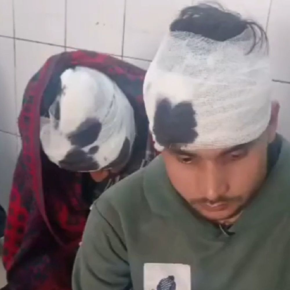 देवरिया में दो भाइयों पर हमला:चाकू-रॉड से किया वार, दोनों की हालत गंभीर