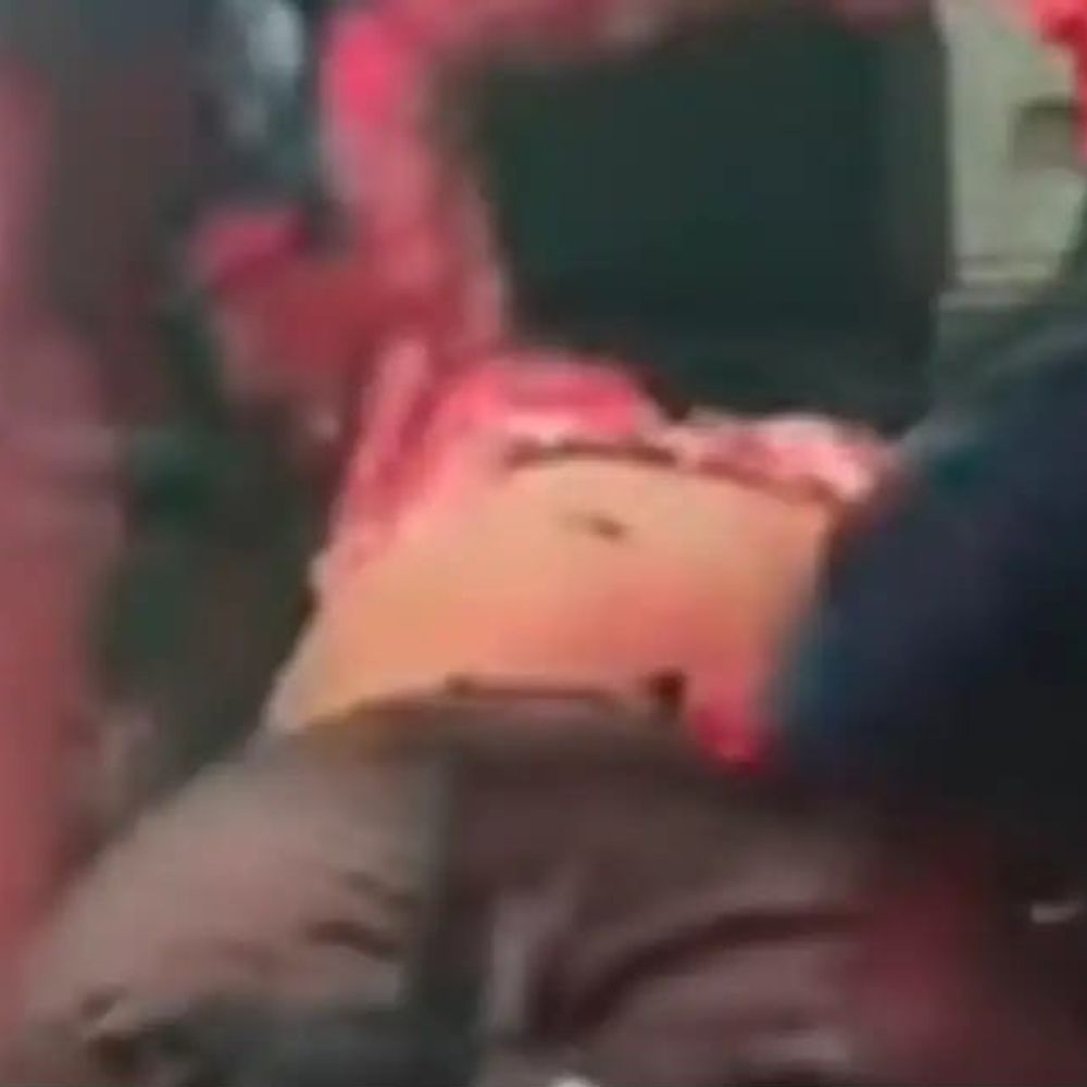 जौनपुर में सड़क हादसे में युवक की मौत:अज्ञात वाहन की टक्कर से घायल, वाराणसी में इलाज के दौरान तोड़ा दम