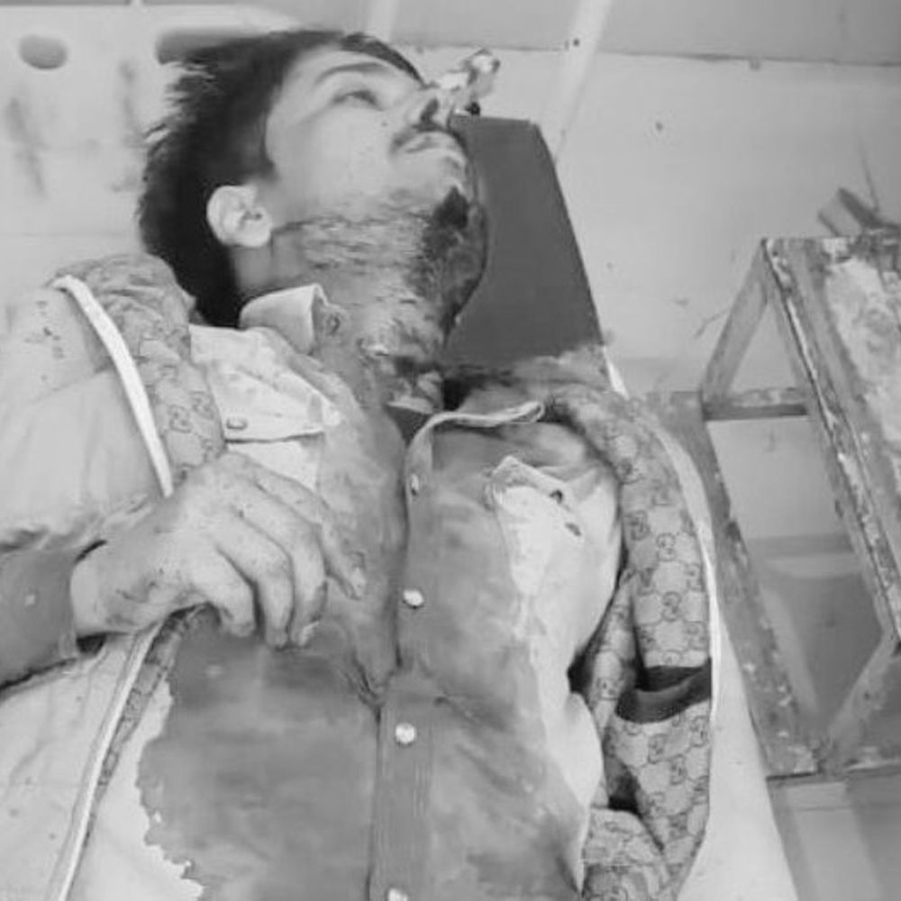 फिरोजाबाद में विवाहिता ने की आत्महत्या:प्रेमी ने भी खुद का गला रेता, गंभीर हालत में अस्पताल में भर्ती