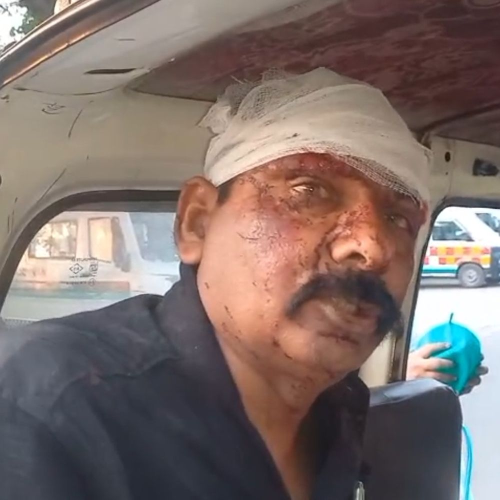 फिरोजाबाद हाईवे पर वेगनार कार ट्रक से टकराई:तीन घायल, एक गंभीर; शादी समारोह से लौटते समय