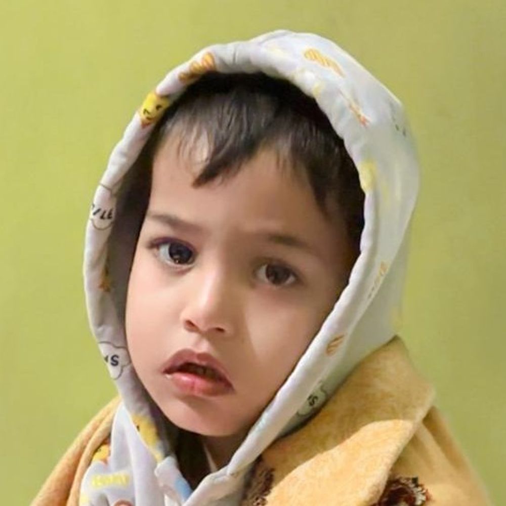 कार ने ई-रिक्शा को टक्कर मारी, मासूम की मौत:चालक समेत परिवार के 4 घायल, फर्रुखाबाद में शादी से लौटते समय हादसा