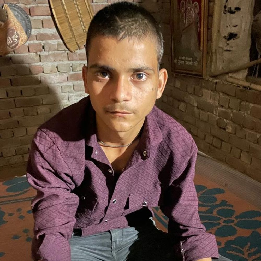 आगरा में फिर पुलिस ने दी थर्ड डिग्री:छात्र को पुलिस चौकी में बुलाकर पीटा, छात्र का हाथ टूटा; दो दरोगा निलंबित