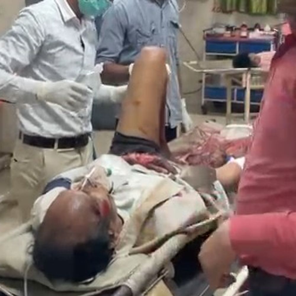 ट्रैक्टर की टक्कर से बाइक सवार डॉक्टर घायल:गंभीर हालत में लोहिया अस्पताल से कानपुर रेफर