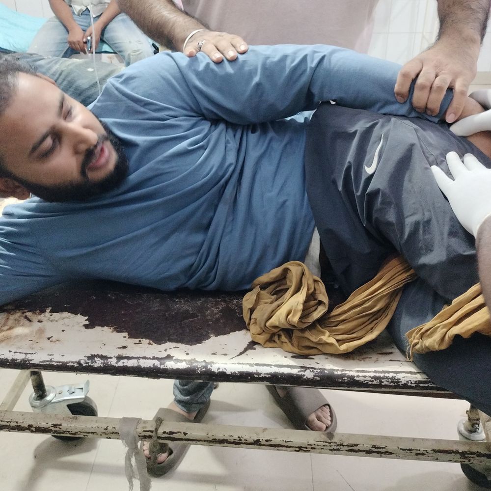 लुधियाना में युवक पर फायरिंग:  बाईं जांघ में लगी गोली, दही लेने निकला था, दो आरोपियों के खिलाफ केस दर्ज – Ludhiana News