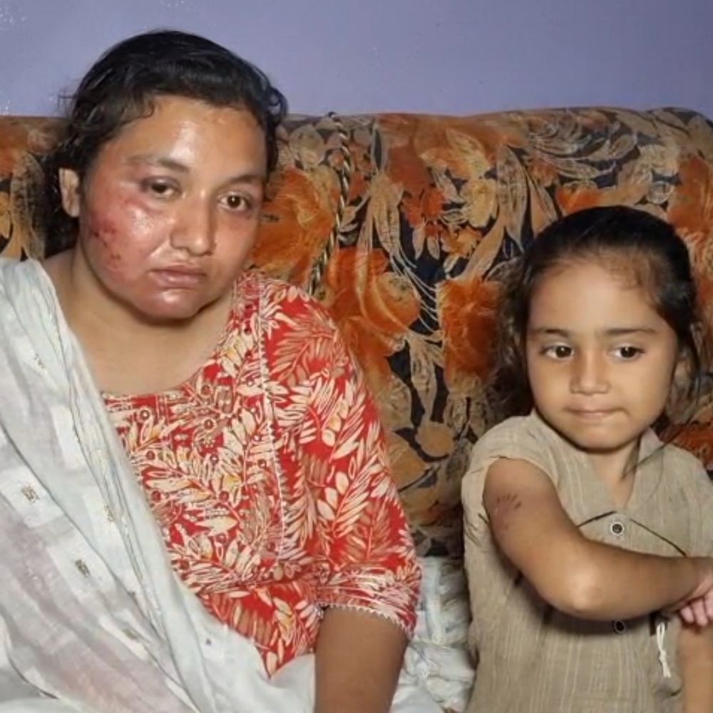 हरदोई में 5 साल की बच्ची ने मां को बचाया:हमलावरों ने कुत्ता छोड़ा, 200 मीटर दौड़कर बच्ची कोतवाली पहुंची, दो गिरफ्तार