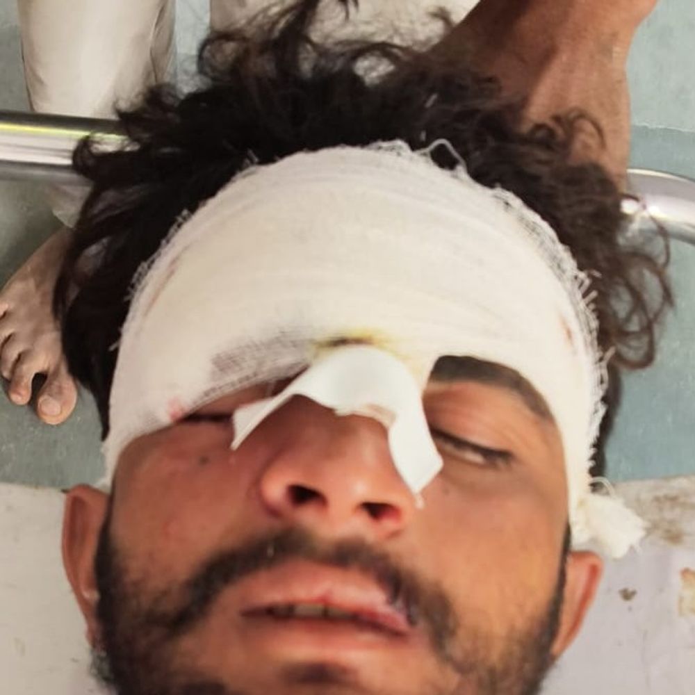 मुरादाबाद में रास्ते के विवाद पर हमला:खेत में जुताई कर रहे युवक को चचेरे भाइयों ने मारी गोली, हालत गंभीर