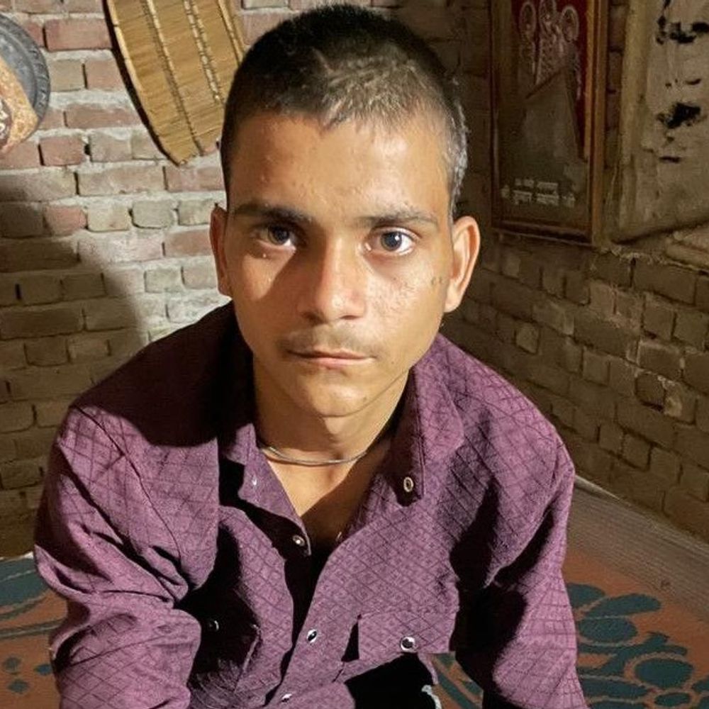 आगरा में पुलिस की पिटाई से छात्र का हाथ टूटा:चौकी में बुलाकर पीटा, हाईस्कूल की परीक्षा देना मुश्किल हुआ, दो दरोगा सस्पेंड