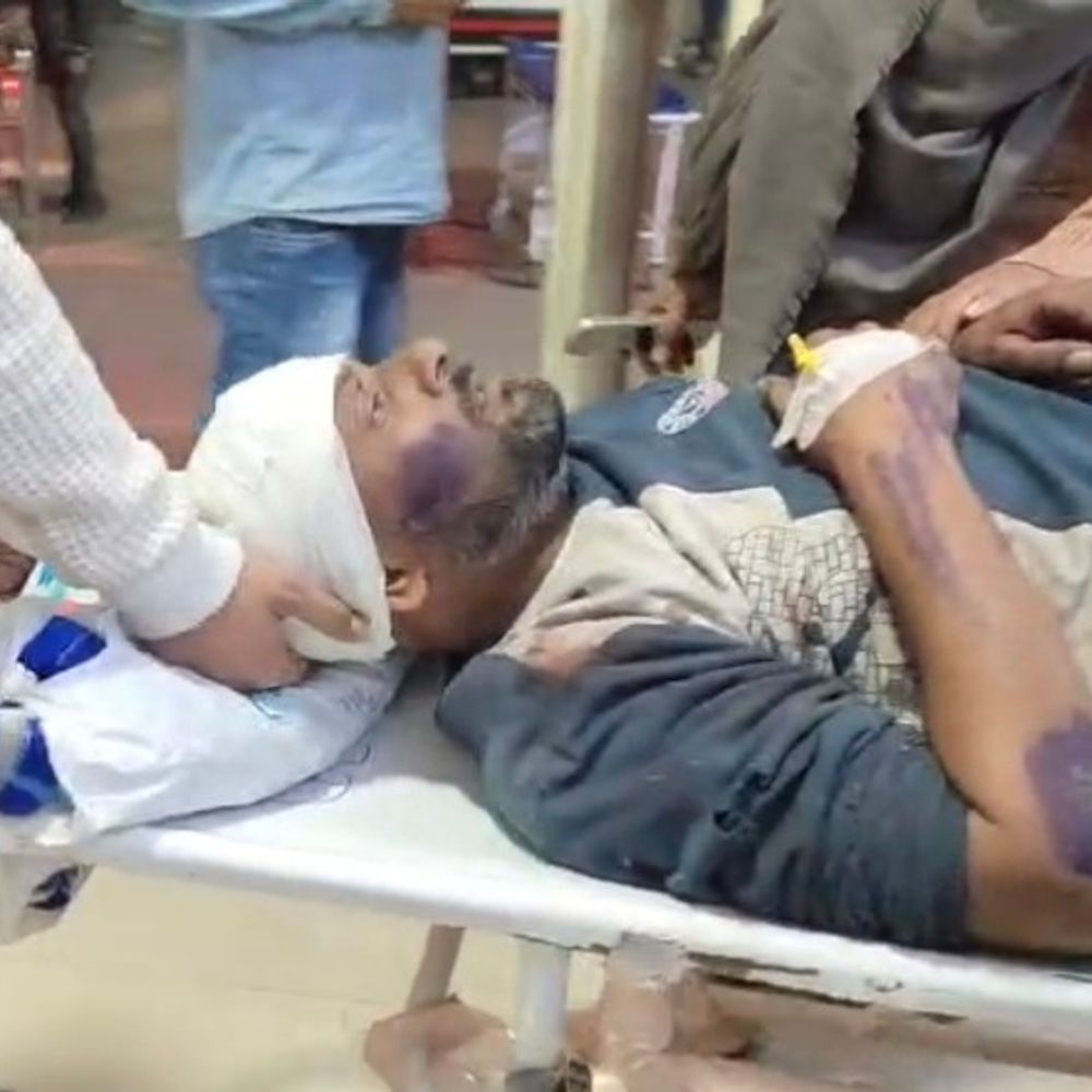 सहारनपुर में एक्सीडेंट में 6 लोग घायल:कंटेनर से जा रहे थे, डंपर से टकराए, अस्पताल में भर्ती