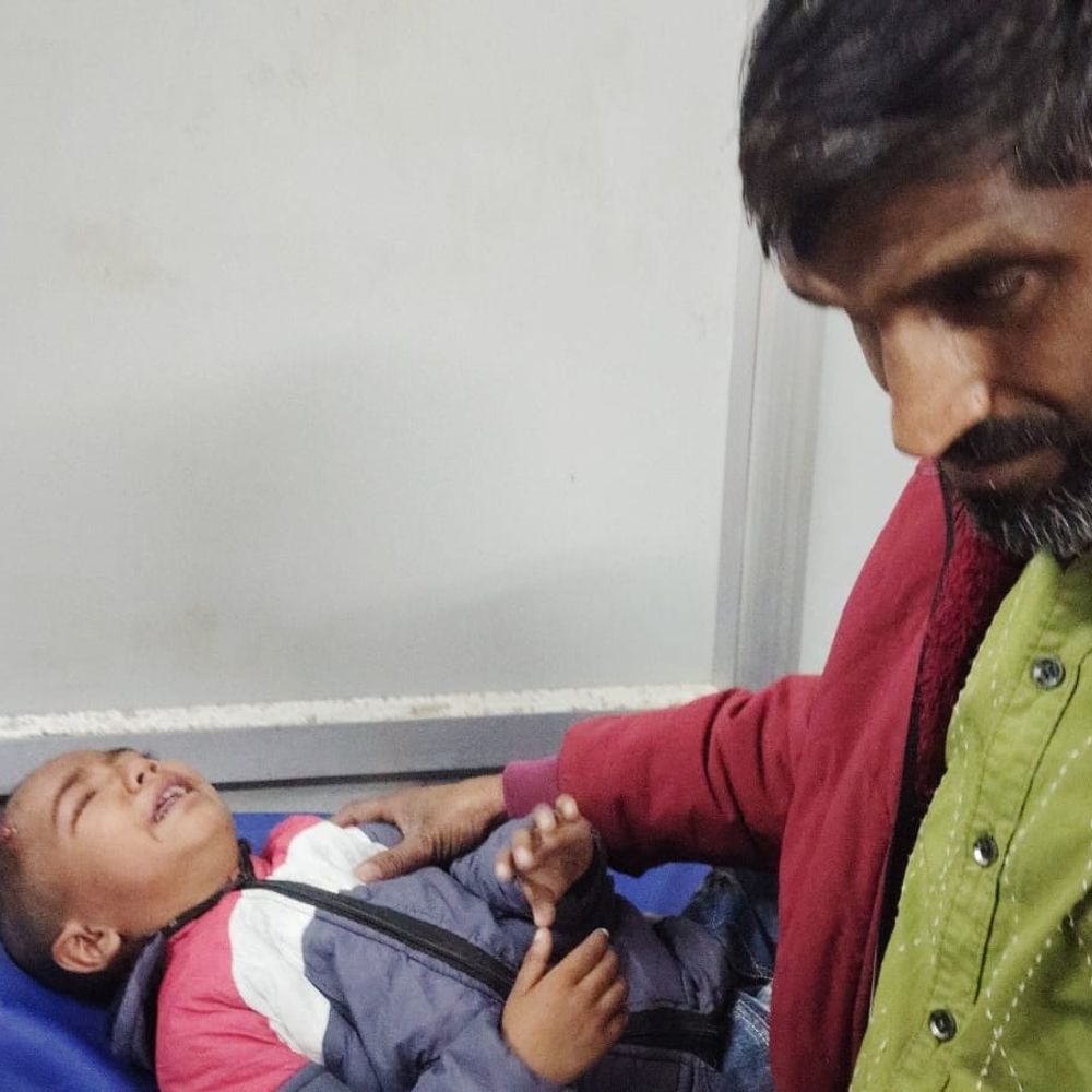 बाराबंकी में बंदर ने मासूम बच्चे पर हमला किया:सिर में गंभीर चोट, लोगों के भगाया तो बच्चे पर झपटा