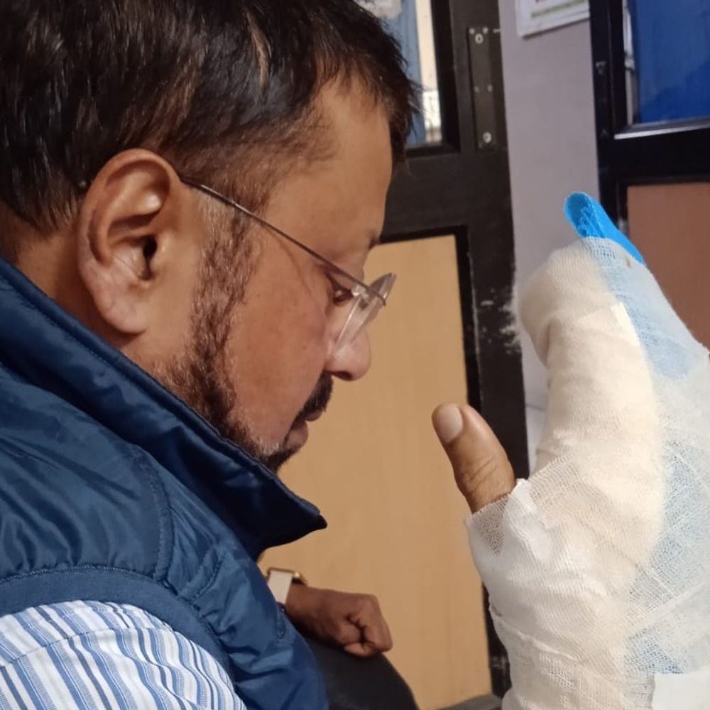 चाइनीज मांझे से कटी डॉक्टर की अंगुली:अलीगढ़ के इमरजेंसी मेडिकल ऑफीसर की हालत गंभीर, दिल्ली रेफर