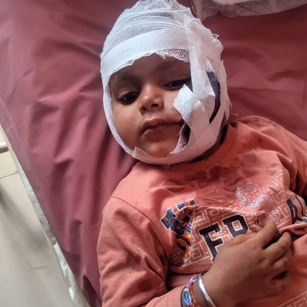 आवारा कुत्तों ने 3 बच्चों समेत 4 को काटा:बाराबंकी में घर के बाहर खेल रहे थे मासूम, एक बच्ची गंभीर