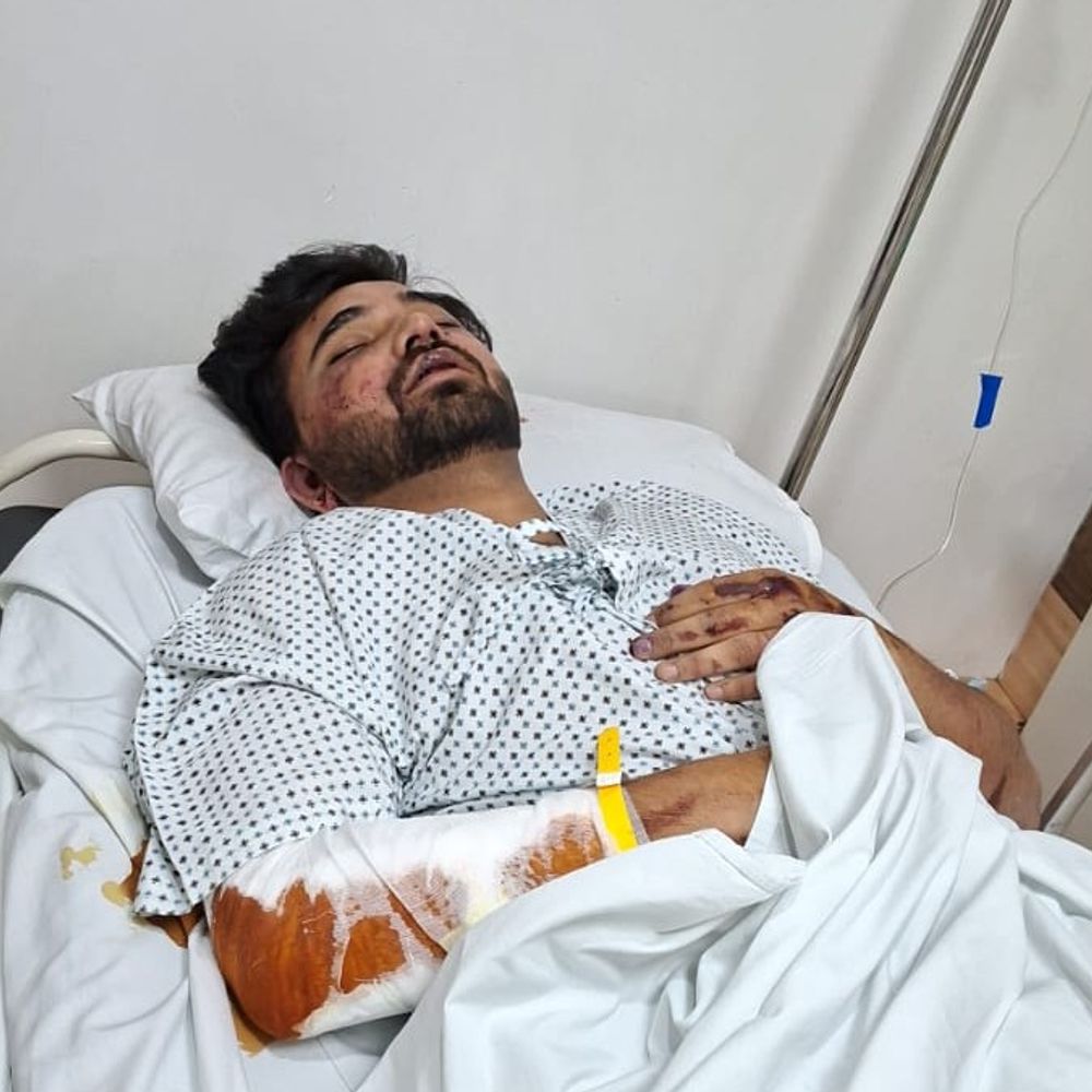 सुशांत गोल्फ सिटी में आधी रात बवाल:स्कॉर्पियो रुकवाकर रॉड, कुर्सी-टेबल से पीटा, घायल युवक ICU में भर्ती