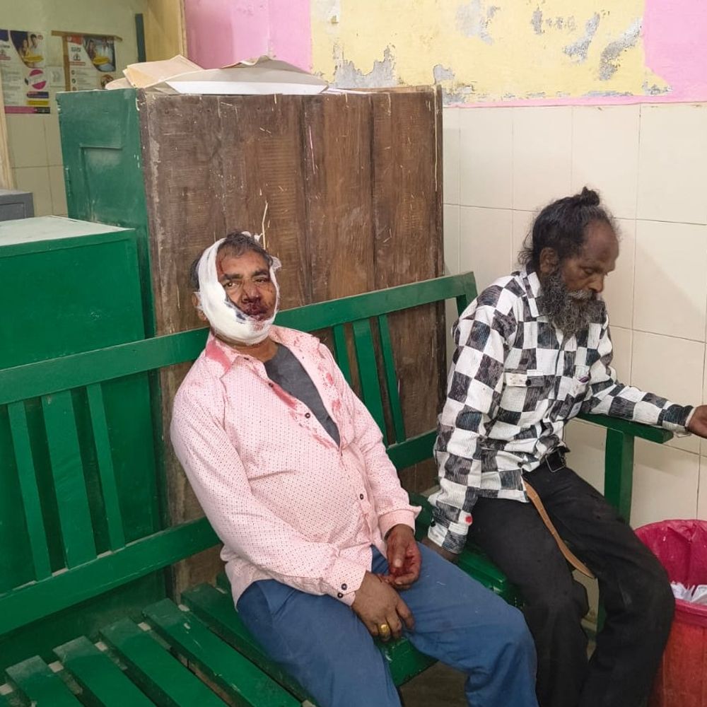 पूर्वांचल एक्सप्रेस-वे पर हादसा, चार लोग घायल:सुल्तानपुर से एक घायल को अंबेडकरनगर किया गया रेफर, क्षतिग्रस्त हुई गाड़ी