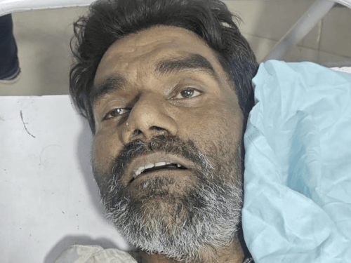 लुधियाना हिट एंड रन मामला:  ढंडारी फ्लाईओवर के नीचे दो की मौत, फरार ऑटो चालक पर केस दर्ज – Ludhiana News