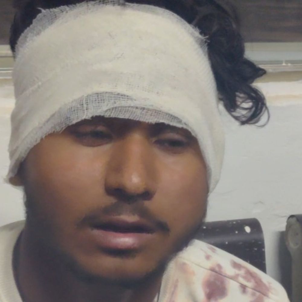 इंटर के 3 छात्रों को लाठी-डंडों से पीटा:पेपर देकर लौट रहे थे, एक को जबरन गाड़ी में बैठाया, 3 किलोमीटर दूर फेंका