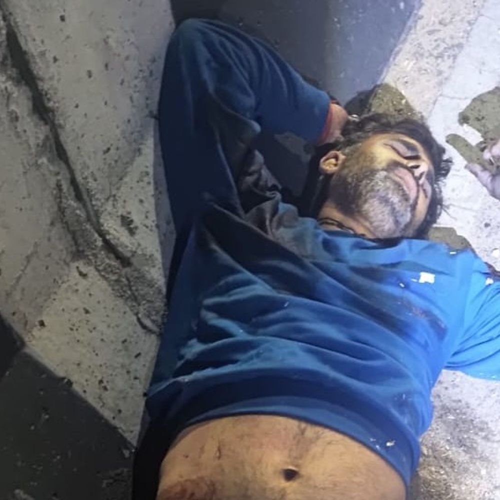 इटावा में बस-डंपर की टक्कर:खाली जा रही थी स्लीपर बस, कंडक्टर घायल, पुलिस ने वाहन हटवाकर जाम खुलवाया