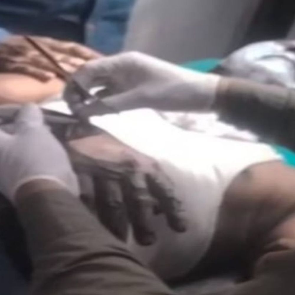 लखनऊ के बिजली उपकेंद्र में करंट से झुलसा संविदा कर्मी:सिविल अस्पताल में कराया भर्ती, लाइन फॉल्ट दूर करने गया था