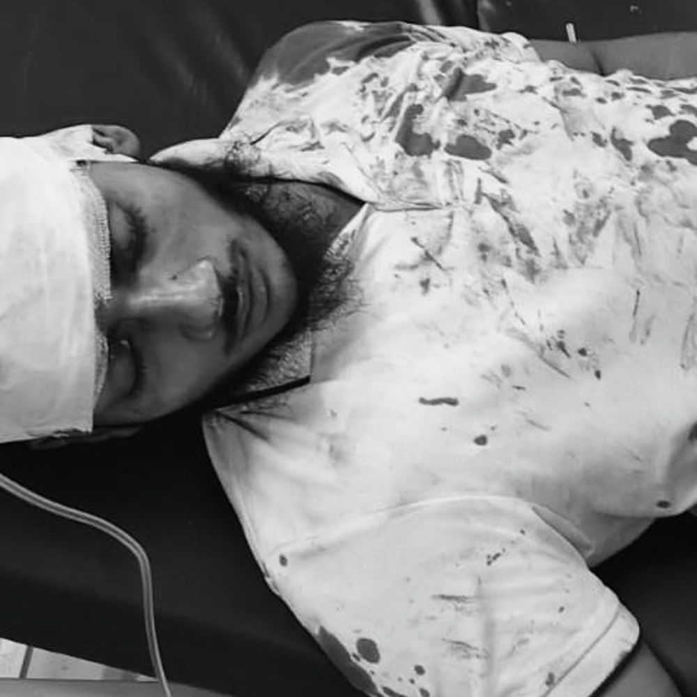 कन्नौज में आलू खेत से ट्रैक्टर निकालने पर मारपीट:ईंट-पत्थर चले, 7 घायल; 20 लोगों पर FIR दर्ज