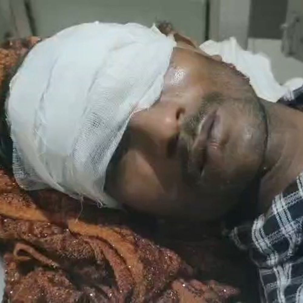 खेतों की रखवाली कर रहे युवक पर सियार का हमला:सीतापुर जिला अस्पताल में युवक गंभीर घायल, आंख में गहरी चोट, अस्पताल में उपचार जारी