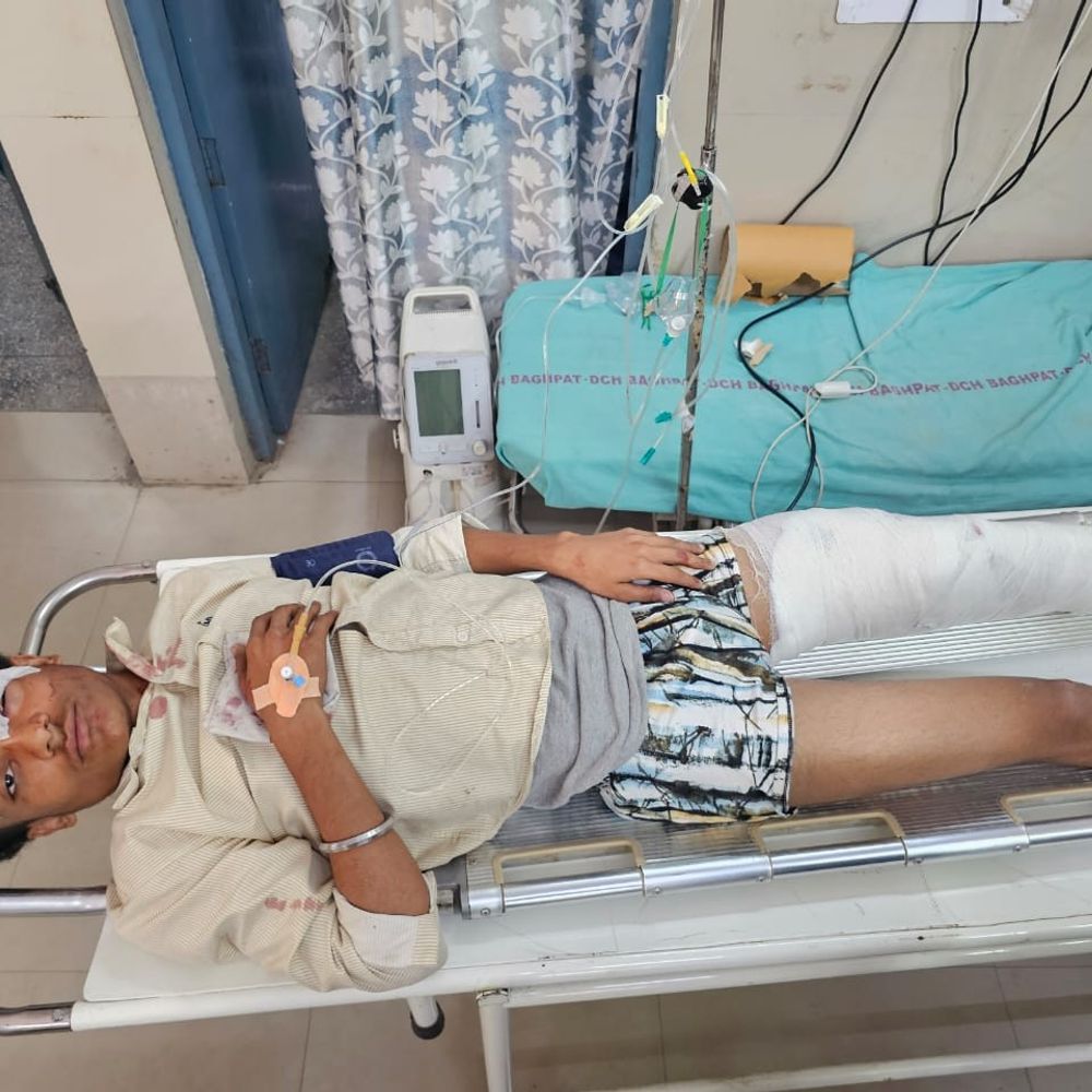 बागपत में मीतली का किशोर सड़क हादसे में गंभीर घायल:अज्ञात ट्रक से बाइक टकराई, हायर सेंटर रेफर