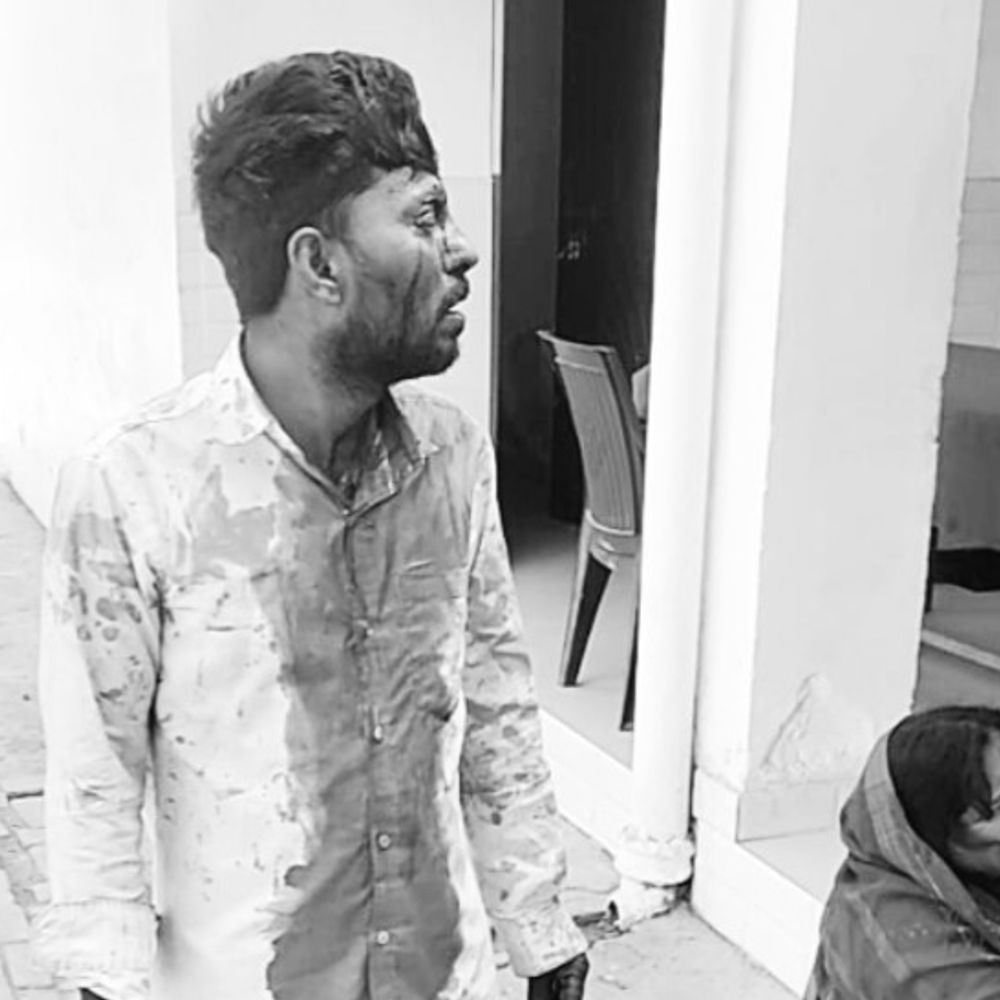 प्रतापगढ़ में जमीन विवाद, 5 लोग घायल:पुलिस ने 6 महिलाओं सहित 10 पर मुकदमा दर्ज किया