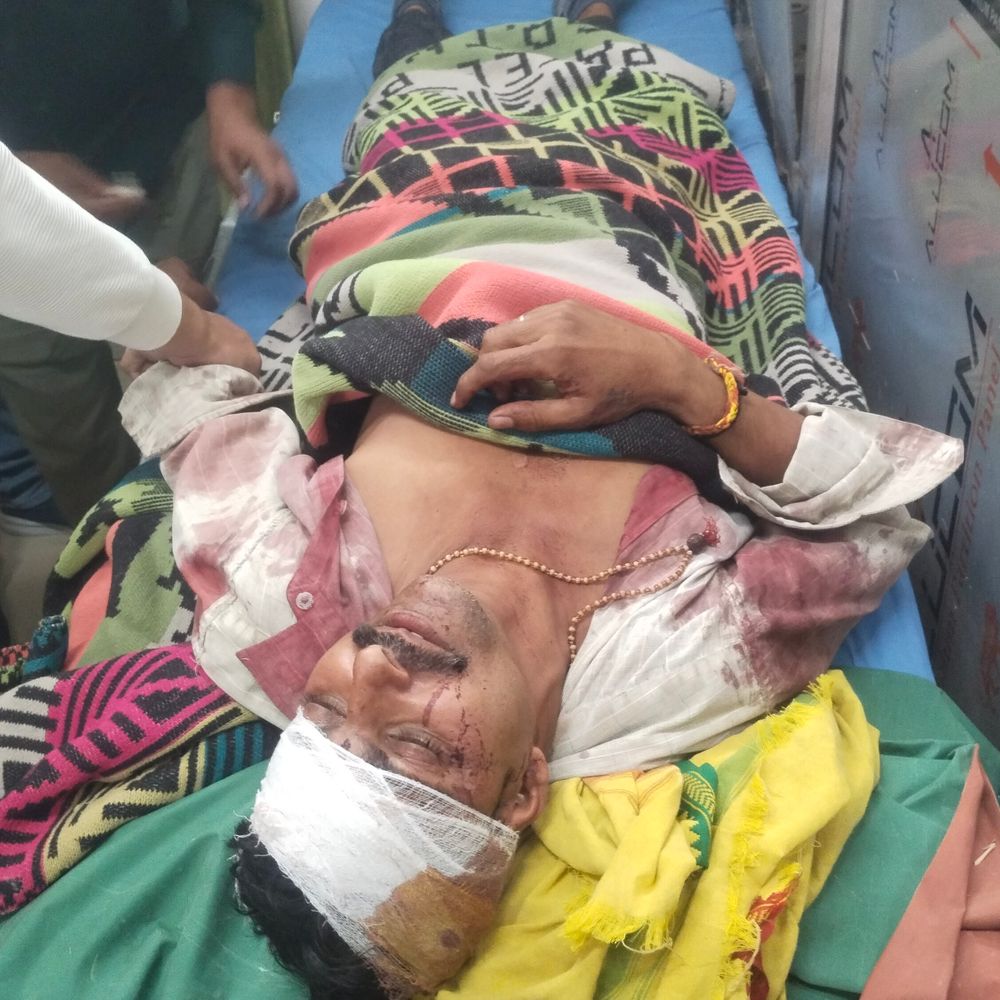 ललितपुर में युवक पर कुल्हाड़ी से हमला:बचाने आए दंपति को भी पीटा, दो गंभीर, झांसी रेफर
