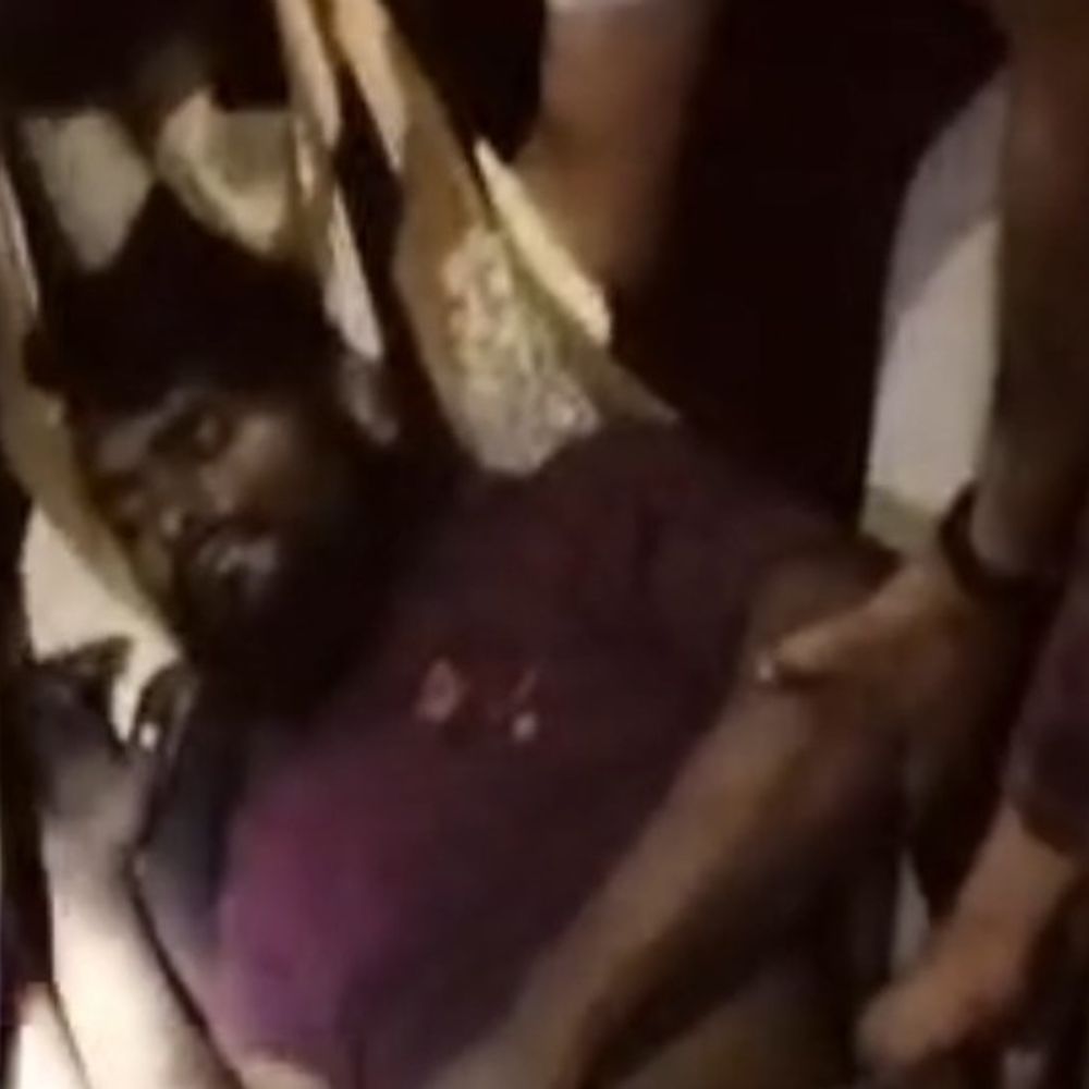 कोरबा में मालगाड़ी की चपेट में आया ट्रक ड्राइवर:  दाहिना पैर कटा, रेलवे ट्रैक पार करते समय हादसा, इलाज जारी – Korba News