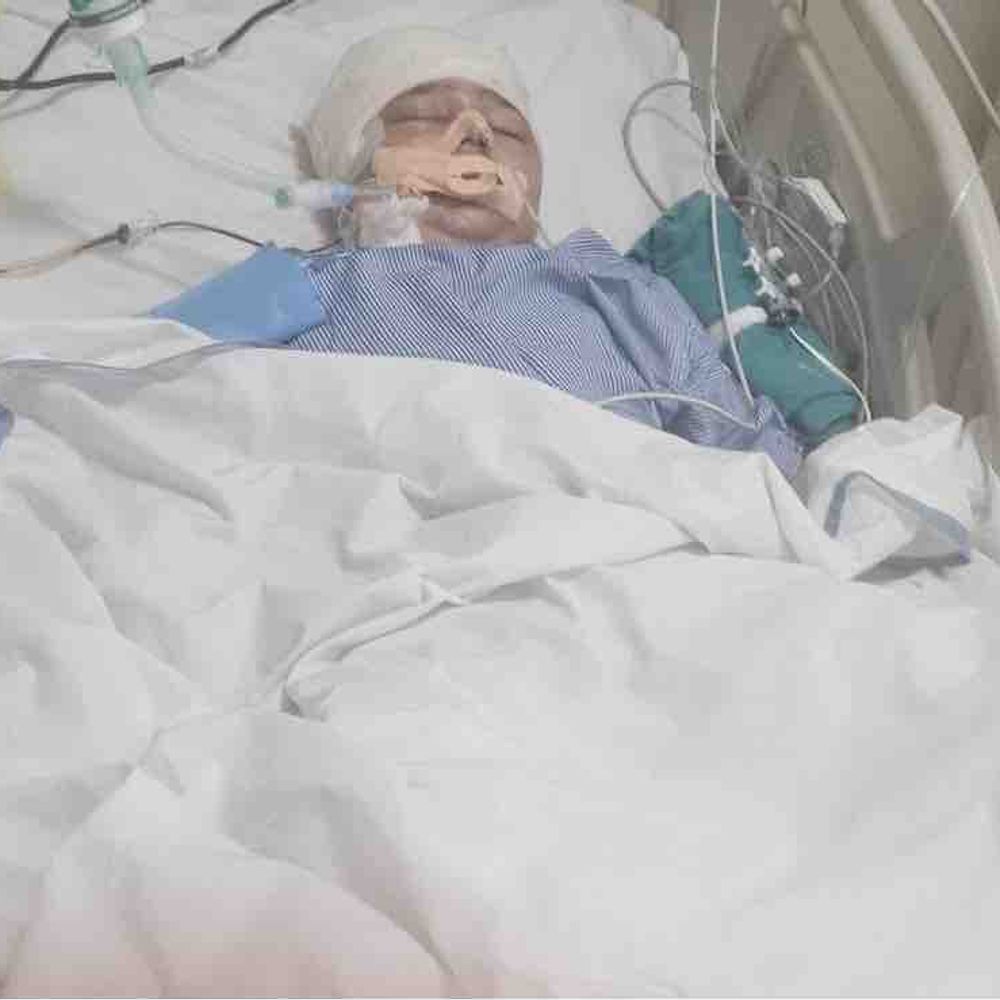 हर्ष फायरिंग में घायल बच्चा वेंटिलेटर सपोर्ट से हटा:चिकित्सकों ने बताया, उसकी हालत में अब सुधार है