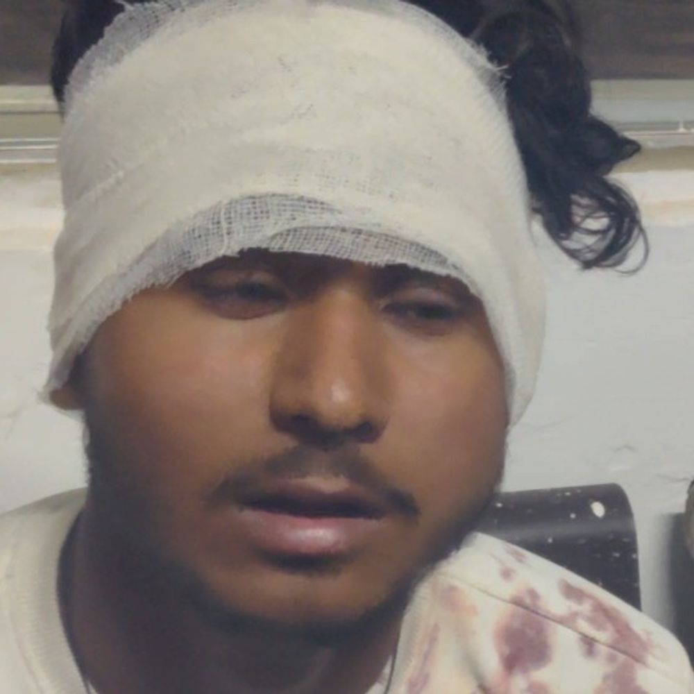 देवरिया में छात्र पर रॉड से हमला, सिप फटा:10 आरोपियों के खिलाफ मामला दर्ज, बोर्ड पेपर देकर लौट रहा था