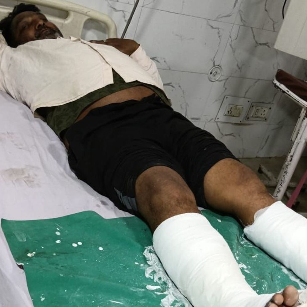 मुरादाबाद में MDA जेई की 'गुंडई',मिस्त्री के हाथ-पैर तोड़े:बिल्डिंग निर्माण कर रही लेबर को डंडों से पीटा; बचने की कोशिश में 2 छत से गिरे