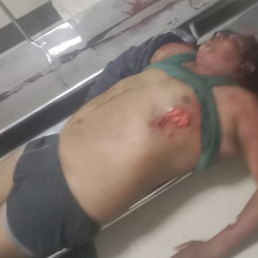 अयोध्या में गोली मारकर युवक की हत्या:एक महीने पहले खरीदी थी जमीन, कब्जा लेने के दौरान हुआ विवाद