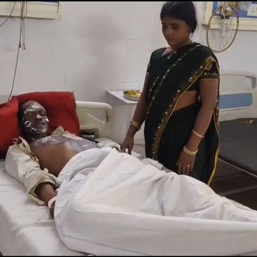 ट्रेन में करंट लगने से यात्री झुलसा:जनरल डिब्बे में कर रहा था सफर, उतरते समय खुले इलेक्ट्रिक बॉक्स पर हाथ लगा