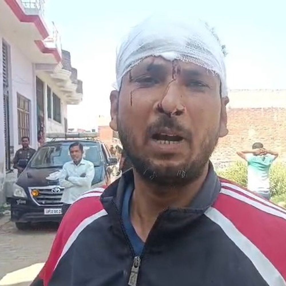 ईदगाह कॉलोनी में प्लॉट कब्जे को लेकर विवाद:उन्नाव में विरोध करने पर प्लॉट मालिकों पर हमला, कई घायल