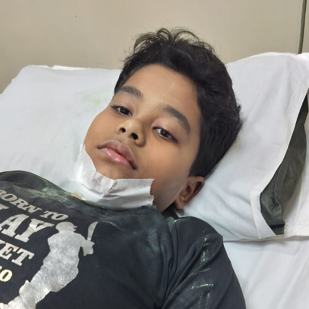 14 साल के बच्चे के मुंह में घुसा सरिया:मेंटेनेंस टीम पर लापरवाही का आरोप, दूसरा बच्चा भी घायल