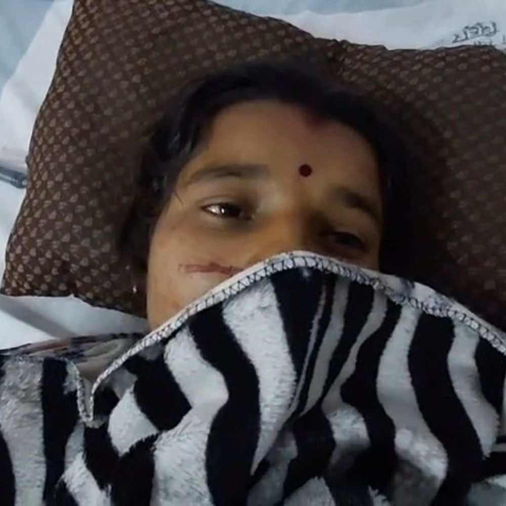 शराबी पति ने पत्नी को लाठी-डंडे, ईंट से पीटा:घरेलू हिंसा में मारपीट,एक बार गया है जेल; महिला अस्पताल में भर्ती