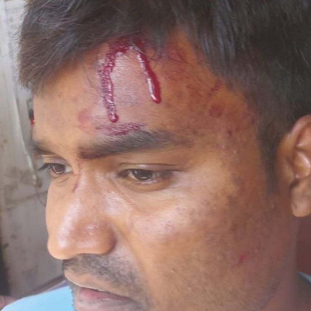 बर्रा में आवारा कुत्तों को भगाने पर विवाद:पड़ोसी ने पिता-पुत्र को पीटा, पुलिस ने एक आरोपी को पकड़ा