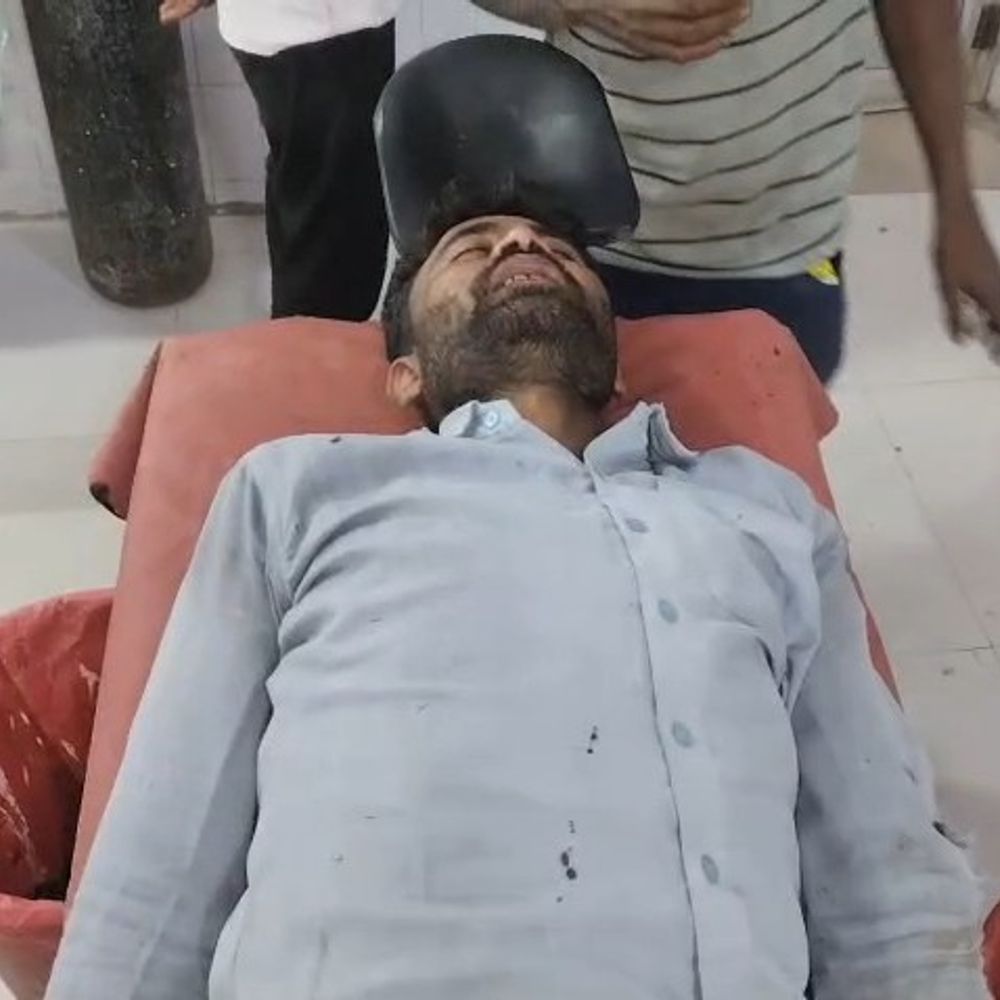 जंगली सूअर ने किसान को जबड़े में दबोचा:महोबा में पालतू कुत्तों ने लड़कर बचाई जान