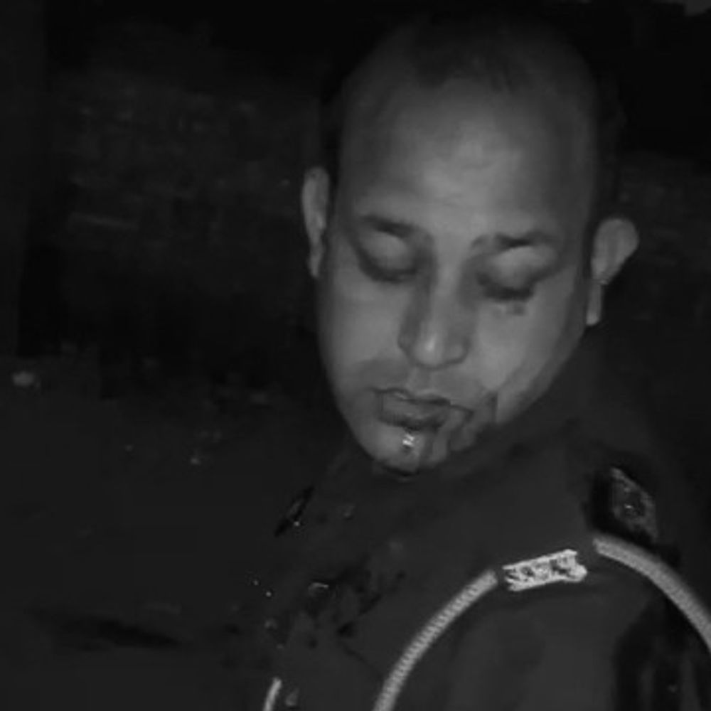 अमरोहा में सिपाही पर गंडासे से हमला:गश्त के दौरान गंभीर घायल, आरोपी हिरासत में पूछताछ जारी