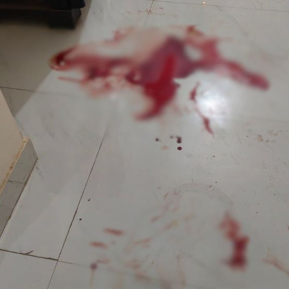 गाजियाबाद में पत्नी को चाकू गोदकर मार डाला:चरित्र पर शक करता था, बेटी पर भी हमला; पति फरार