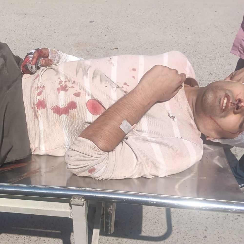 बागपत में शराब के नशे में बाइक अनियंत्रित हुई:कलेक्ट्रेट में युवक हुआ गंभीर घायल, अस्पताल में भर्ती