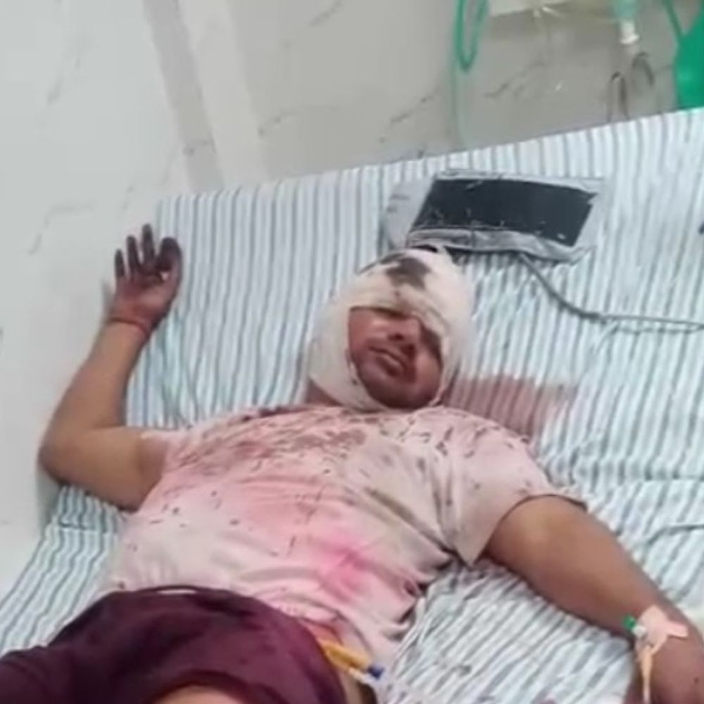 देवरिया में भूमि विवाद, युवक की उंगली कटी:सिर पर चाकू से वार, गोरखपुर मेडिकल कॉलेज रेफर