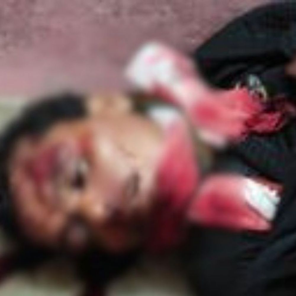 धौरहरा में सड़क हादसे में युवक की मौत:इलाज के दौरान तोड़ा दम, ससुराल से लौटते समय अज्ञात वाहन ने मारी टक्कर