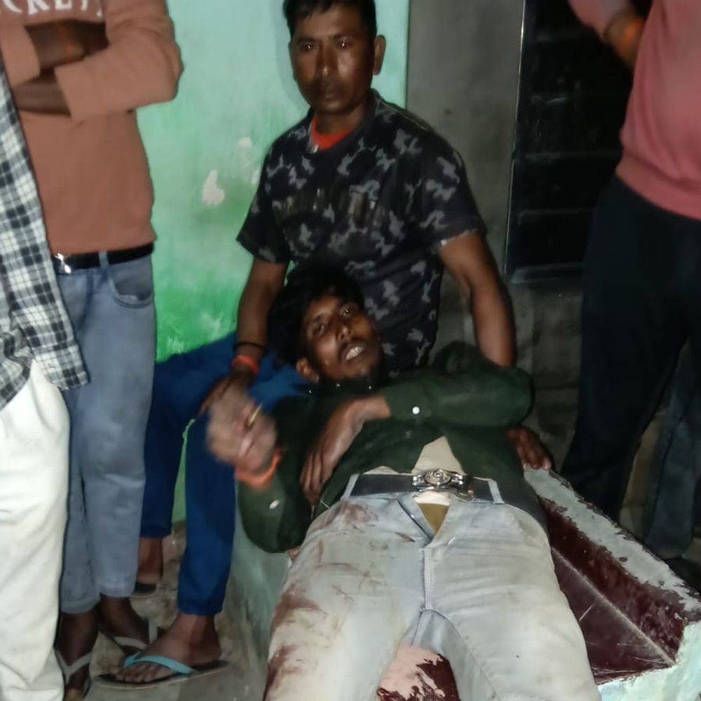 नवाबगंज में होलिका दहन की तैयारी में मारी गोली:युवक गंभीर हालत में बरेली रेफर, आरोपी पर मुकदमा दर्ज