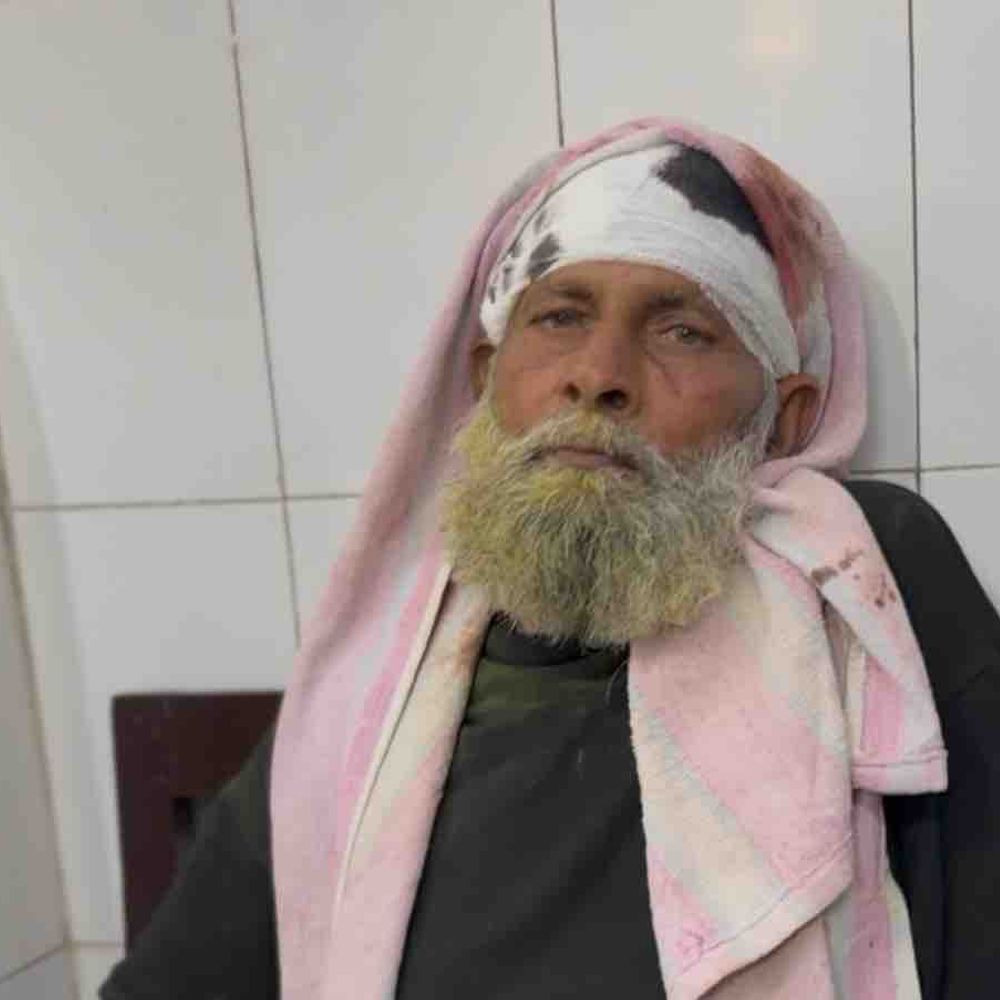 कबूतर चोरी विवाद में बुजुर्ग पर जानलेवा हमला, हालत गंभीर:5 लोगों ने धारदार हथियार से किया वार, केस दर्ज