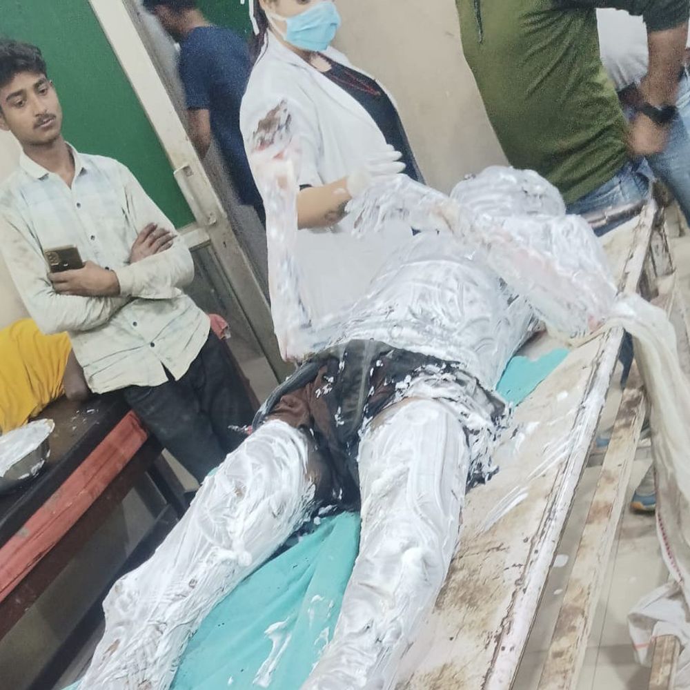 मैनपुरी में पेट्रोल डालकर युवक ने खुद को लगाई आग:शराब के नशे में था, गंभीर हालत में जिला अस्पताल से सैफई रेफर